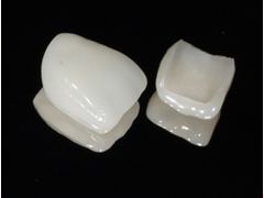 【概要】薄い板状のセラミックを歯の表面に貼り付ける方法